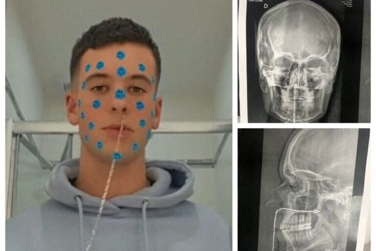 Que signifie rêver de sortir quelque chose de son nez 1 une personne retirant un objet de son nez