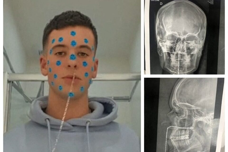 Que signifie rêver de sortir quelque chose de son nez